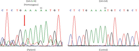 https://www.archivesofmedicalscience.com/f/fulltexts/127368/AMS-22-4-127368-g004_min.jpg