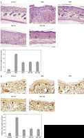 https://www.archivesofmedicalscience.com/f/fulltexts/127459/AMS-22-4-127459-g001_min.jpg