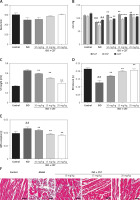 https://www.archivesofmedicalscience.com/f/fulltexts/127588/AMS-22-4-127588-g002_min.jpg