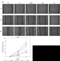https://www.archivesofmedicalscience.com/f/fulltexts/127589/AMS-22-4-127589-g002_min.jpg