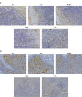 https://www.archivesofmedicalscience.com/f/fulltexts/127589/AMS-22-4-127589-g005_min.jpg