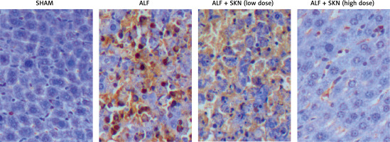 https://www.archivesofmedicalscience.com/f/fulltexts/127659/AMS-22-4-127659-g002_min.jpg