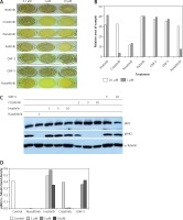 https://www.archivesofmedicalscience.com/f/fulltexts/127894/AMS-17-1-127894-g005_min.jpg