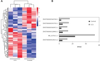 https://www.archivesofmedicalscience.com/f/fulltexts/128014/AMS-19-1-128014-g001_min.jpg