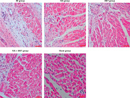 https://www.archivesofmedicalscience.com/f/fulltexts/128742/AMS-19-5-128742-g002_min.jpg