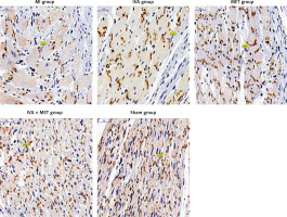 https://www.archivesofmedicalscience.com/f/fulltexts/128742/AMS-19-5-128742-g005_min.jpg