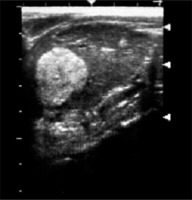 https://www.archivesofmedicalscience.com/f/fulltexts/130994/AMS-21-3-130994-g001_min.jpg