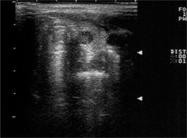 https://www.archivesofmedicalscience.com/f/fulltexts/130994/AMS-21-3-130994-g002_min.jpg