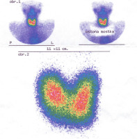 https://www.archivesofmedicalscience.com/f/fulltexts/130994/AMS-21-3-130994-g004_min.jpg