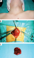 https://www.archivesofmedicalscience.com/f/fulltexts/130994/AMS-21-3-130994-g005_min.jpg