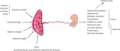 https://www.archivesofmedicalscience.com/f/fulltexts/132778/AMS-19-6-132778-g001_min.jpg