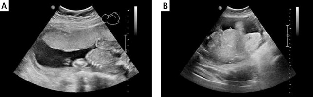 https://www.archivesofmedicalscience.com/f/fulltexts/132778/AMS-19-6-132778-g002_min.jpg