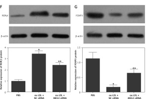 https://www.archivesofmedicalscience.com/f/fulltexts/133731/AMS-22-3-133731-g005_min.jpg