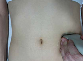 https://www.archivesofmedicalscience.com/f/fulltexts/135708/AMS-19-4-135708-g001_min.jpg
