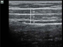 https://www.archivesofmedicalscience.com/f/fulltexts/135708/AMS-19-4-135708-g002_min.jpg