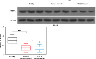 https://www.archivesofmedicalscience.com/f/fulltexts/136284/AMS-19-6-136284-g001_min.jpg