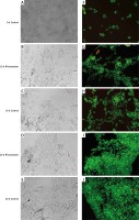 https://www.archivesofmedicalscience.com/f/fulltexts/136323/AMS-18-4-136323-g001_min.jpg