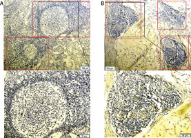 https://www.archivesofmedicalscience.com/f/fulltexts/140622/AMS-20-1-140622-g001_min.jpg