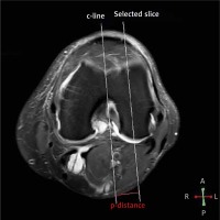 https://www.archivesofmedicalscience.com/f/fulltexts/140714/AMS-18-4-140714-g002_min.jpg