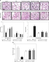 https://www.archivesofmedicalscience.com/f/fulltexts/146792/AMS-18-3-146792-g002_min.jpg