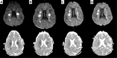 https://www.archivesofmedicalscience.com/f/fulltexts/146978/AMS-19-6-146978-g001_min.jpg