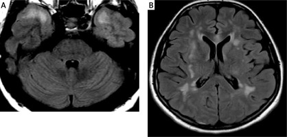 https://www.archivesofmedicalscience.com/f/fulltexts/146978/AMS-19-6-146978-g002_min.jpg