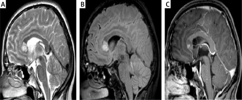 https://www.archivesofmedicalscience.com/f/fulltexts/146978/AMS-19-6-146978-g005_min.jpg