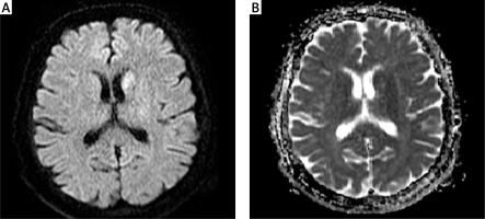 https://www.archivesofmedicalscience.com/f/fulltexts/149502/AMS-18-4-149502-g001_min.jpg