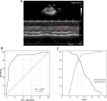 https://www.archivesofmedicalscience.com/f/fulltexts/150461/AMS-18-4-150461-g001_min.jpg