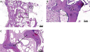 https://www.archivesofmedicalscience.com/f/fulltexts/153510/AMS-19-6-153510-g002_min.jpg