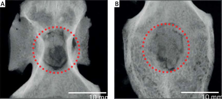 https://www.archivesofmedicalscience.com/f/fulltexts/153510/AMS-19-6-153510-g003_min.jpg