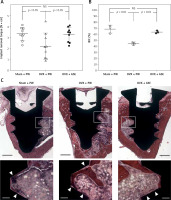 https://www.archivesofmedicalscience.com/f/fulltexts/153510/AMS-19-6-153510-g004_min.jpg