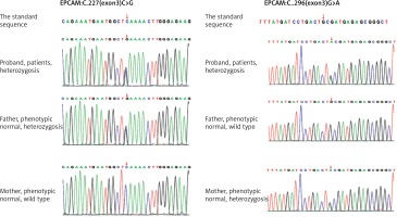 https://www.archivesofmedicalscience.com/f/fulltexts/155185/AMS-18-6-155185-g002_min.jpg