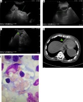 https://www.archivesofmedicalscience.com/f/fulltexts/158536/AMS-19-1-158536-g001_min.jpg