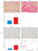 https://www.archivesofmedicalscience.com/f/fulltexts/160941/AMS-19-2-160941-g001_min.jpg