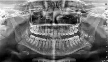https://www.archivesofmedicalscience.com/f/fulltexts/161229/AMS-19-2-161229-g002_min.jpg