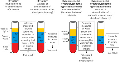 https://www.archivesofmedicalscience.com/f/fulltexts/161578/AMS-19-6-161578-g003_min.jpg