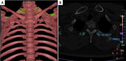 https://www.archivesofmedicalscience.com/f/fulltexts/161702/AMS-19-3-161702-g001_min.jpg