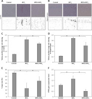 https://www.archivesofmedicalscience.com/f/fulltexts/163353/AMS-19-3-163353-g001_min.jpg