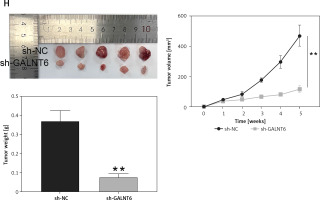 https://www.archivesofmedicalscience.com/f/fulltexts/163530/AMS-21-3-163530-g005_min.jpg