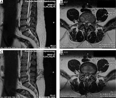 https://www.archivesofmedicalscience.com/f/fulltexts/165859/AMS-19-4-165859-g001_min.jpg