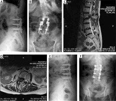 https://www.archivesofmedicalscience.com/f/fulltexts/165859/AMS-19-4-165859-g002_min.jpg