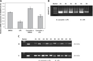 https://www.archivesofmedicalscience.com/f/fulltexts/167396/AMS-19-6-167396-g002_min.jpg