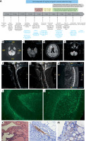 https://www.archivesofmedicalscience.com/f/fulltexts/169135/AMS-19-5-169135-g001_min.jpg