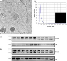 https://www.archivesofmedicalscience.com/f/fulltexts/169382/AMS-20-2-169382-g001_min.jpg