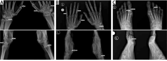 https://www.archivesofmedicalscience.com/f/fulltexts/169476/AMS-19-5-169476-g002_min.jpg