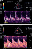 https://www.archivesofmedicalscience.com/f/fulltexts/169478/AMS-19-5-169478-g001a_min.jpg