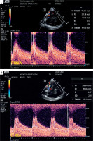 https://www.archivesofmedicalscience.com/f/fulltexts/169478/AMS-19-5-169478-g001b_min.jpg