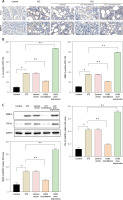 https://www.archivesofmedicalscience.com/f/fulltexts/170160/AMS-20-1-170160-g006_min.jpg