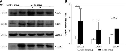 https://www.archivesofmedicalscience.com/f/fulltexts/170910/AMS-19-5-170910-g004_min.jpg